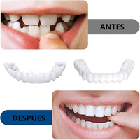 Sonrisa Instantánea Snap-On 😁✨